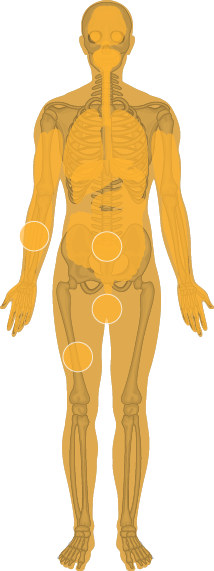 Sarin on human skin